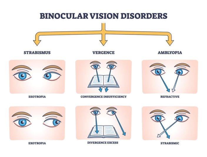 binocular convergence