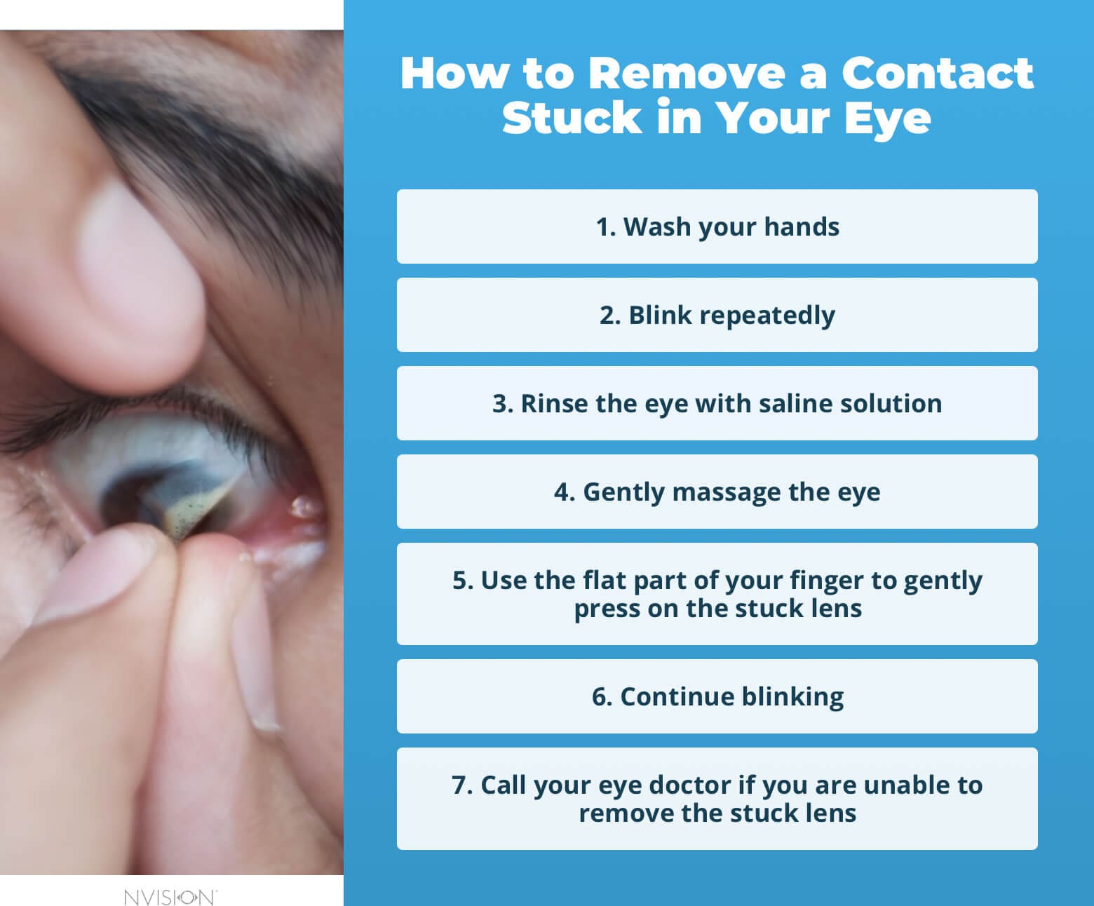 How To Safely Remove A Contact Lens Stuck In Your Eye