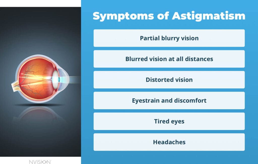 Astigmatism Testing Online Test For Symptoms Causes NVISION 2022 