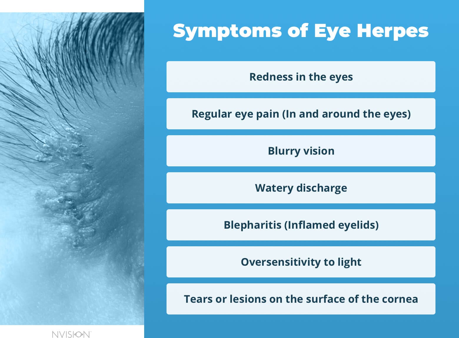 Eye Herpes Causes Treatment What Not To Do NVISION Eye Centers