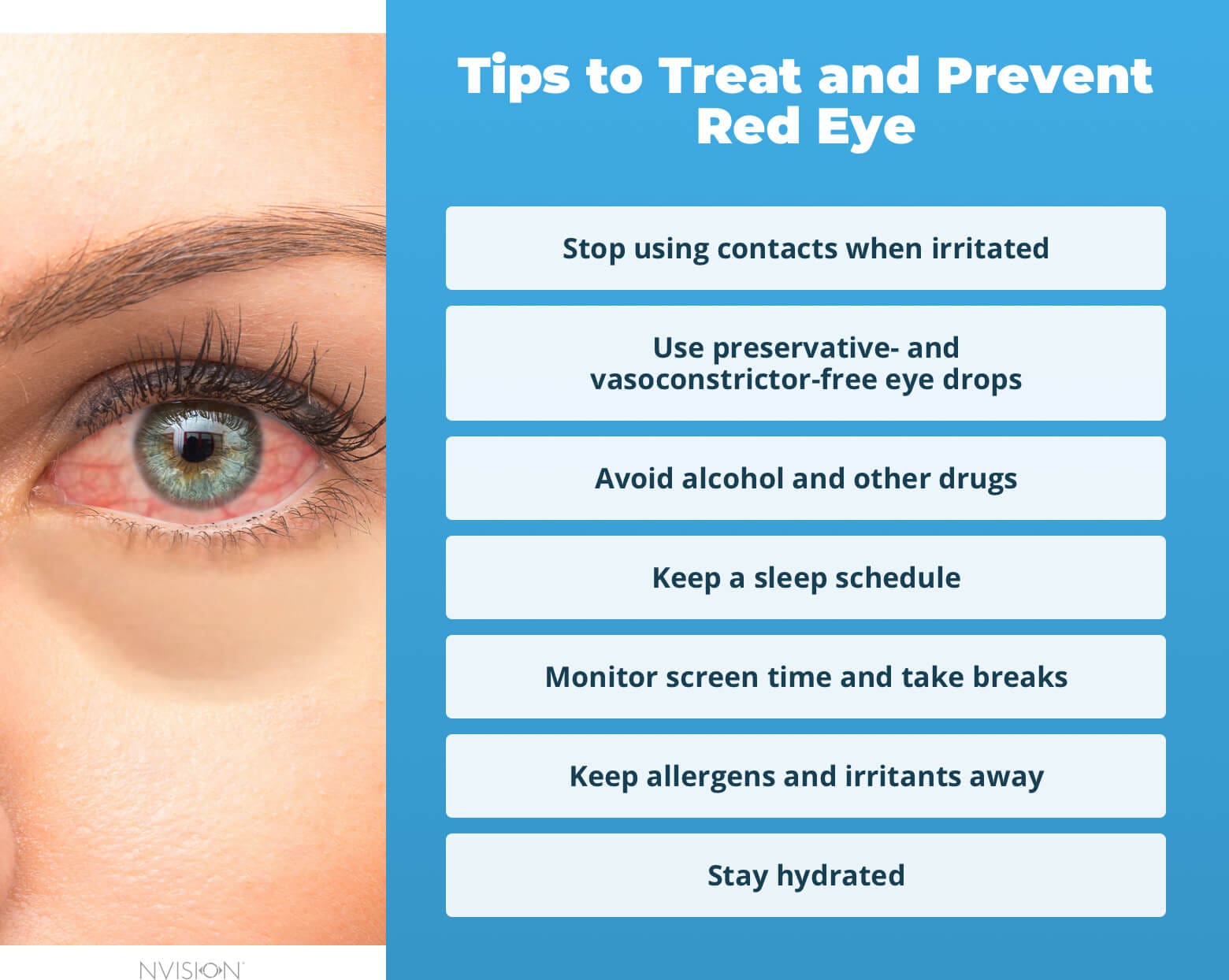 https://www.nvisioncenters.com/wp-content/uploads/Tips-to-Treat-and-Prevent-Red-Eye@2x.jpg