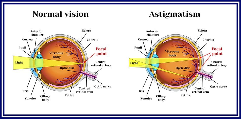 The Best Contact Lenses In 2022 How To Choose NVISION Eye Centers