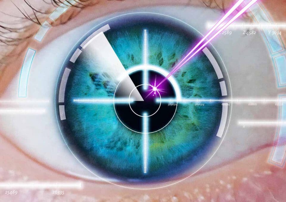 What To Expect After Cataract Surgery Light Sensitivity And More