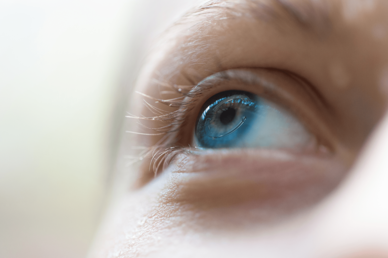 Intacs Corneal Implants for Keratoconus - Are They Right For You?