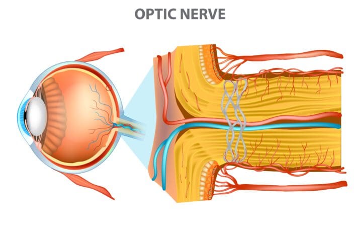 ischemic optic neuropathy