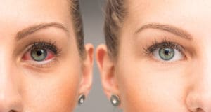 Eye Infection Symptoms: How to Tell (&amp; What to Do) – NVISION